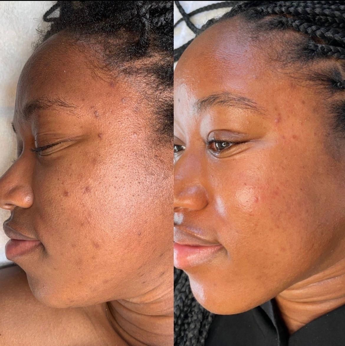 Glass Skin Glow